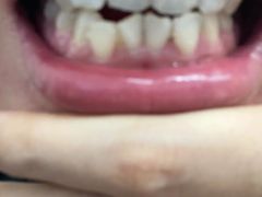 -微笑牙科口腔(三亚迎宾院区)