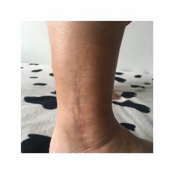 点击看大图 -英刺青 纹身 洗纹身