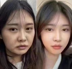 -Yestar 嘉兴艺星医疗美容医院