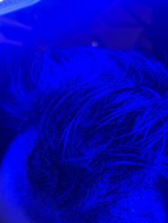 -碧莲盛·不剃发植发