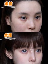 -深圳艺星医疗美容医院
