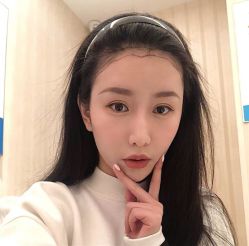 -碧莲盛·不剃发植发