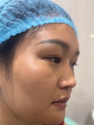 -安徽合肥韩美整形外科医院