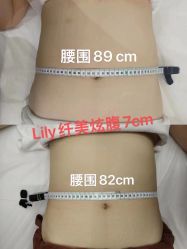 -Lily纤美·科技减脂中心