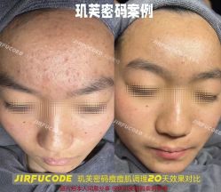 -元熙兰积皮肤管理