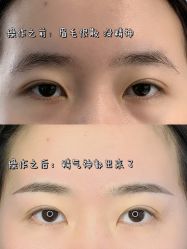 -张小野·专业半永久纹眉