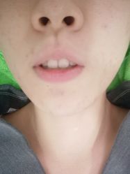 -清颜堂专业祛痘
