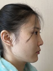 -北京米扬丽格医疗美容·联合丽格鼻整形中心