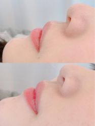 点击看大图 -小梨·OndaPro·专业脱毛连锁机构