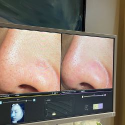 -苑苑vbeauty科技美容SPA