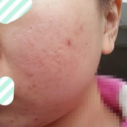 -SKINIST丽铂医疗美容
