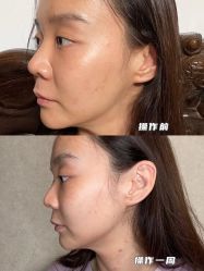 -新美荟医美·专注面部美学抗衰
