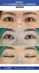 -丰联丽格医疗美容·联合丽格眼整形中心