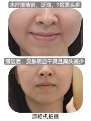 体验前-唯奈斯肌肤管理中心