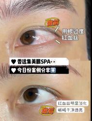 -LUNA皮相美·骨相美高级美感