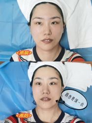 -伊美尔医疗美容医院