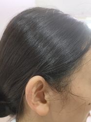 -长沙雅美医疗美容医院