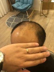 -乐绅男士高端假发定制