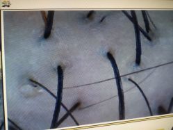 -丝客富脱发养发头皮馆