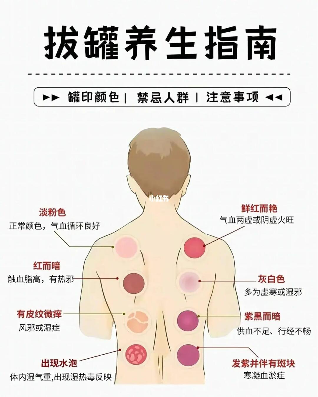 肚子去寒拔罐位置图图片