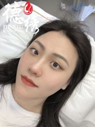 -德绣·机器野生眉发际线·美瞳线半永久