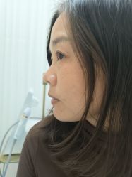 -长沙雅美医疗美容医院