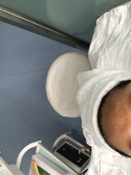 -痘庄专业袪痘皮肤管理连锁