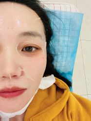 体验前-新美荟医美·专注面部美学抗衰