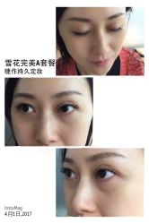 睫毛嫁接-光SPA科技美肤