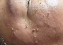 点击看大图 -智丽佳人祛斑祛痘美容美体