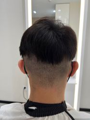 -大麦微针植发全国连锁