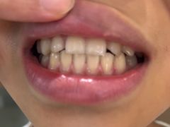 -佛山中大口腔医院·市二级口腔专科医院