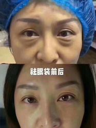 -兰派国际美容养生SPA