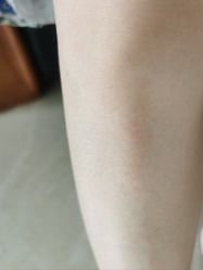 -SKIN79皮肤管理中心