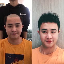 -发饰美男士增发补发假发定制店