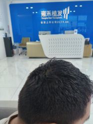 -雍禾植发