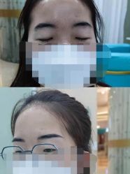 -洁铭新加坡医美