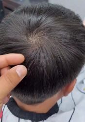 -发饰美男士增发补发假发定制店