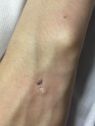 点击看大图 体验后-智丽佳人祛斑祛痘美容美体