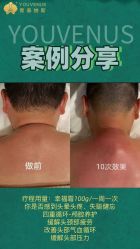 -半岛故事·法儿曼抗衰·indiba中心