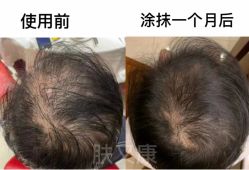 -天其美科学美肤·生发健康管理