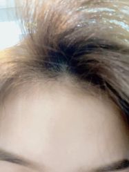 -丽美妍医疗美容·皮秒·立体分层抗衰