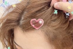 -大麦微针植发全国连锁