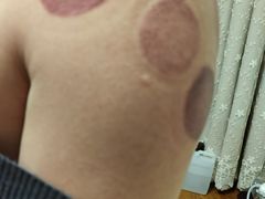 -沈师傅盲人按摩工作室(密三小区店)