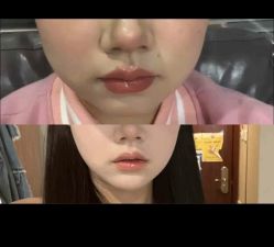 -Dr.U博士医疗美容医院