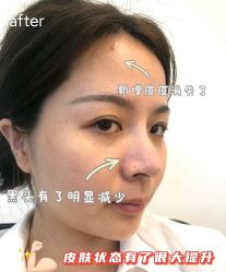 点击看大图 -Yestar宁波艺星整形医院