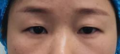 点击看大图 体验前-温州伯思立医院