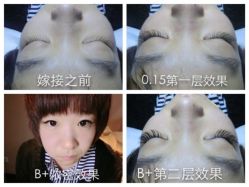 iphone_upload_pic-光SPA科技美肤