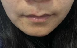 体验后-南京医科大学友谊整形外科医院