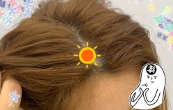 -大麦微针植发全国连锁